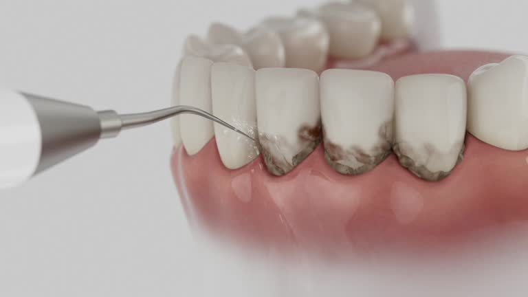 Reliable Dental contractor in Salt Creek Commons, IN by Dentist Open Now